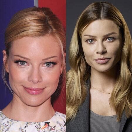 lauren german plastic surgery.